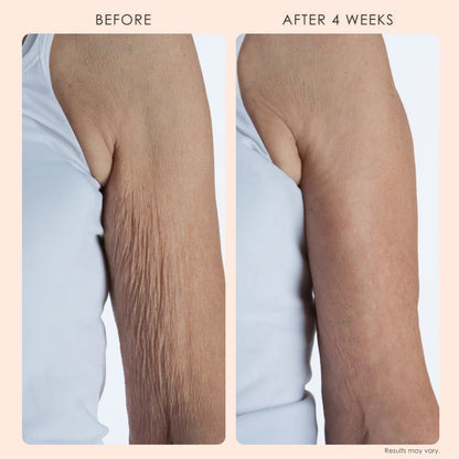 Body Repair Treatment